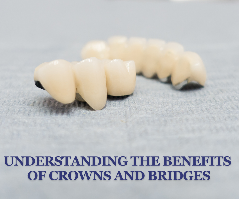 Understanding the Benefits of Crowns and Bridges